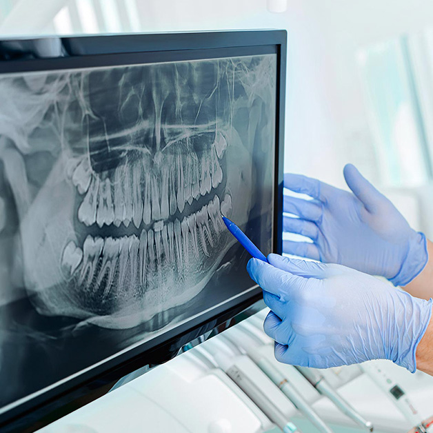 Oralchirurgie